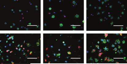 9317 30 20 10 0 0 5 10 15 20 Fold increase of CRT expression % phagocytosis HSP90 50 40 R 2 = 0.