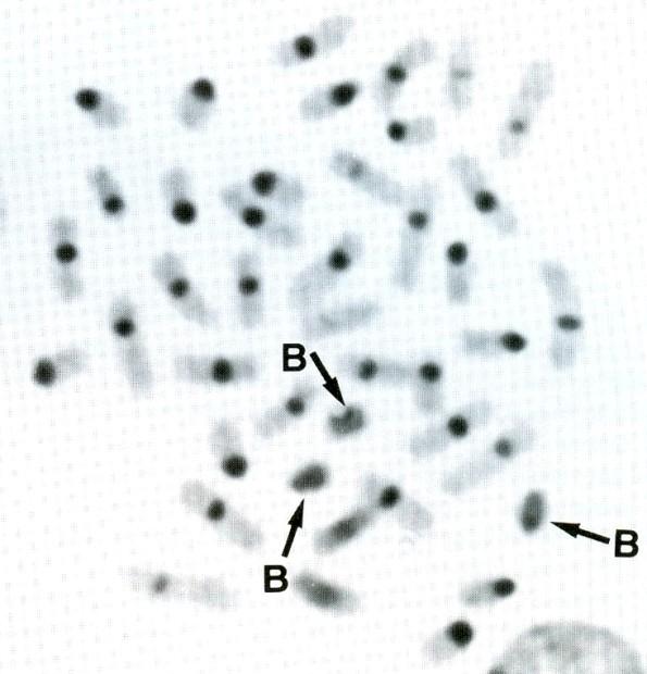 heterochromatinu v solném pufru (2 SSC) za vysoké teploty (60 C) rozpuštění