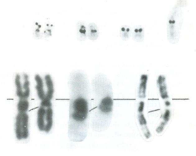 Ag-NOR: Proužkování chromozomů ( banding ) želatina + kyselina mravenčí, barvení