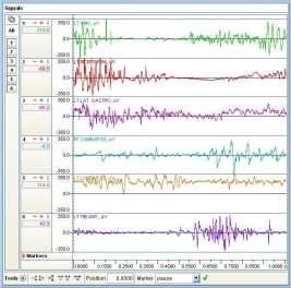 3) V každém řádku je záznam elektrické aktivity svalu v jednotkách µv. Ve spodní části záznamu je časová osa. Je zachycen cyklistický krok s délkou 1,0080 s.