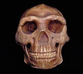 kg/ scull with supraorbital ridge, chinless,