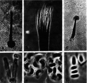 Ophiostoma cucullatum Ophiostoma cucullatum a. plodnice, b.