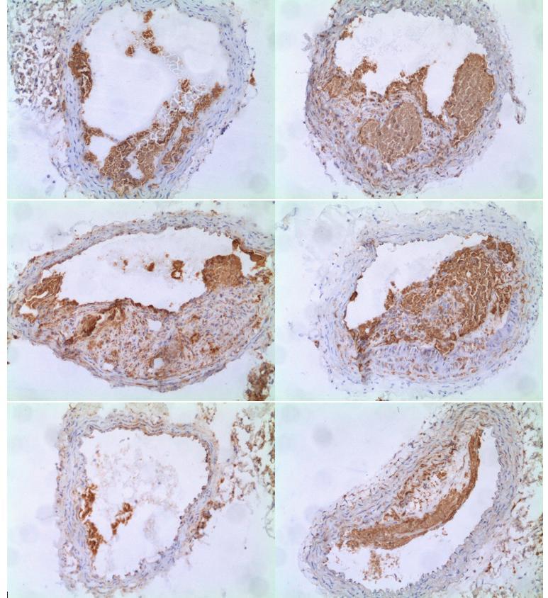 Obrázek 9: Reprezentativní obrázky imunohistochemického barvení makrofágů u kontrolní skupiny zvířat.