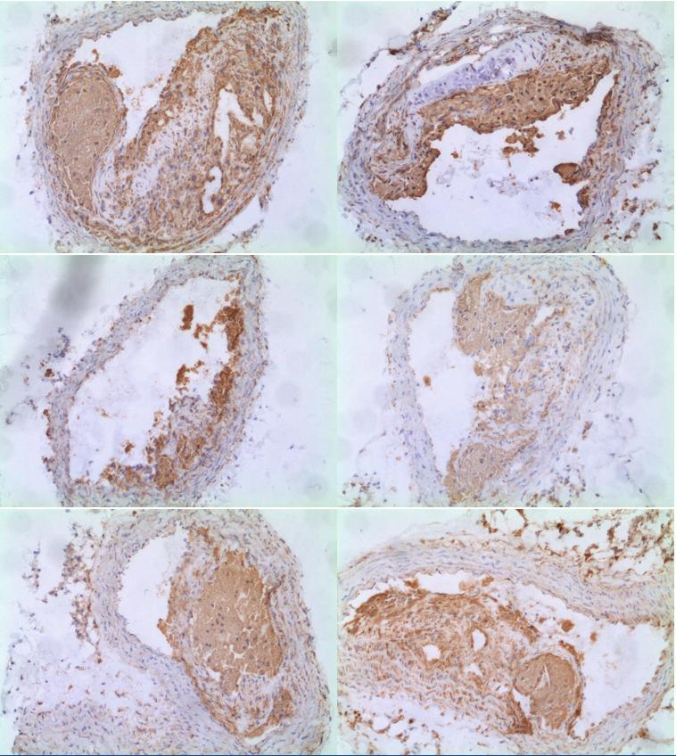 Obrázek 10: Reprezentativní obrázky imunohistochemického barvení makrofágů u LCHP skupiny zvířat.