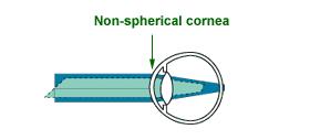 Rozptylka je optická čočka, která přeměňuje rovnoběžný svazek paprsků na rozbíhavý. Uprostřed je tenčí než na okrajích. Rozptylky zmenšují obraz pozorovaného předmětu. Obr.