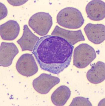 reaktivní lymfocyty, velké granulární