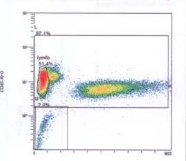 Kazuistika 1 - průtoková cytometrie záchyt B-lymfocytózy 56% z celkových lymfocytů, B-lymfo se vyskytují ve dvou populacích: 1/ 40% normální imunofenotyp 2/ 60% abnormální CD45low+ CD19+ CD20-/low+