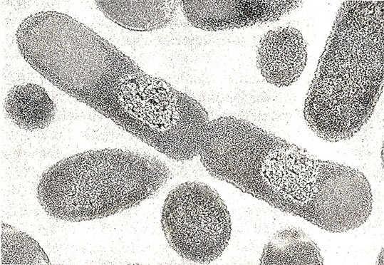 Fig. 7-79. Thin sections of E.