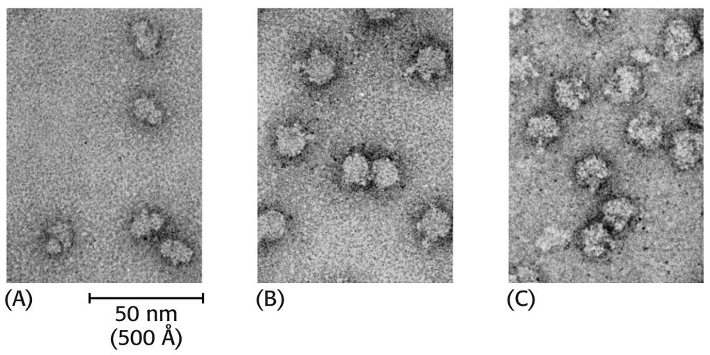 Mikrofotografie ribosomu z elektronového mikroskopu