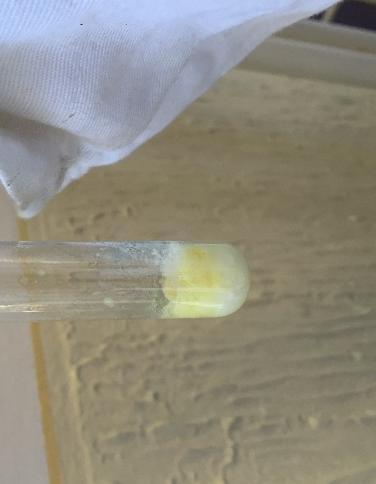 3. Xantoproteinová reakcia Pomôcky: skúmavka, plynový kahan, držiak na skúmavky Chemikálie: vajcový bielok, koncentrovaná kyselina dusičná (HNO 3 Postup práce: Do skúmavky nalejeme vajcový bielok a