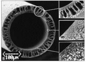 Membrány 5.5.1: We suggest to use dialyzers with a biocompatible membrane for IHD and CRRT in patients with AKI.