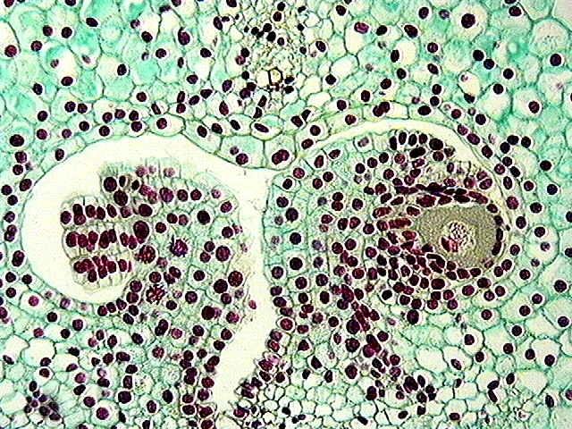 Mid prophase I in the megasporocyte.