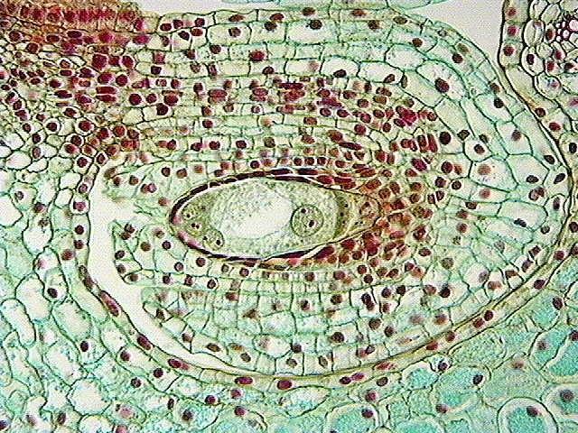 Maturing megagametophyte IASPRR The