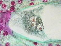 Chalazální konec zárodečného vaku IASPRR The chalazal end of the embryo sac contains the fusing polar nuclei,