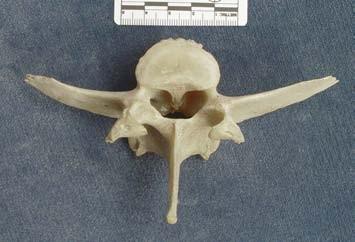 Bederní obratle (vertebrae lumbales): bederní obratle jsou, na rozdíl od hrudních, delší a jejich těla mají jednotný tvar