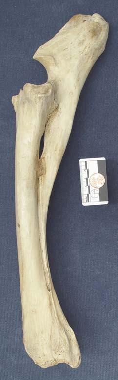 ulna