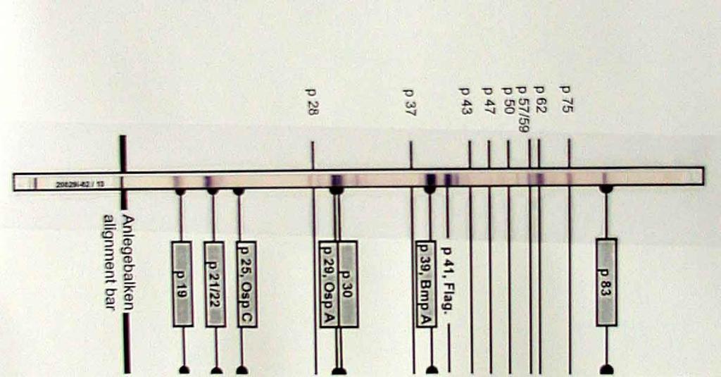 Western blot vzhled