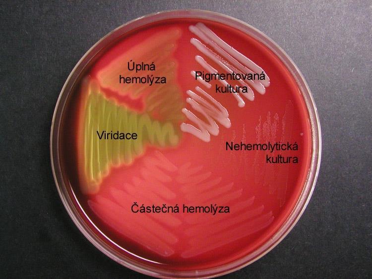 Hemolýza Ke zjištění hemolytické aktivity se používá krevního agaru, příp. dalších agarů s krví.