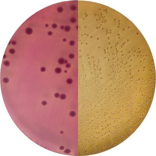 Selektivní složka Krystalová violeť inhibuje růst doprovodné grampozitivní bakteriální flóry ze vzorku.