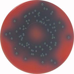 L. monocytogenes - PALCAM agar Oxford agar složení báze g/l agar-agar 13.0 Pepton 23.0; glucose 0.5; starch 1.0 živiny Kvasničný extrakt 3.0; NaCl 5.0 lithium chloride 10.