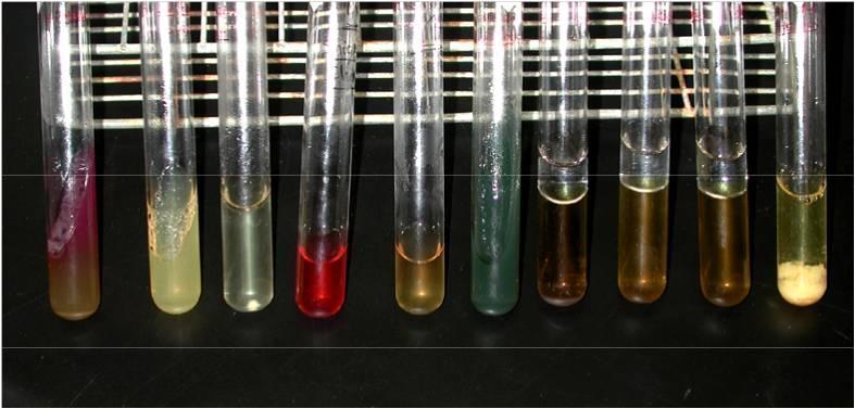 L-lysin dekarboxylasa β-galaktosidasa (ONPG) VP test Indol test Motile (semi-solid nutrient agar) Sérologická (37± C, 24± 3h) O antigeny (somatické) H