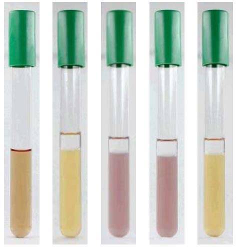 Biochemická konfirmace Salmonella spp.