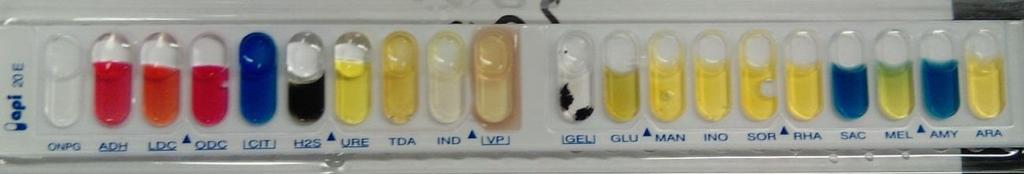 Biochemické testy Erba Lachema ANAEROtest 23 - anaerobní bakterie, vyskytujících se nejčastěji v klinickém materiálu a v potravinách.