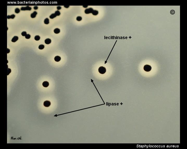 BAIRD-PARKER AGAR (BP) Složení (l): Základní půda (l): Pepton z kaseinu 10.0; masový extrakt 5.0; kvasničný extrakt 1.0; pyruvát sodný 10.0; glycin 12.0; chlorid lithný 5.0; agaragar 15.0. Suplement Emulze vaječného žloutku s teluričitanem Egg-yolk tellurite emulsion 50 ml; pokud požadováno, sulfamethazin 0.