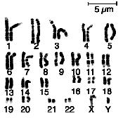 Chromozómy V jadro eukaryontov obsahuje jednu alebo viaceré molekuly DNA organizované do