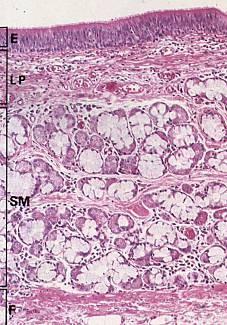 TRACHEA: Epitel Lamina