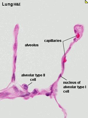 Granulózní pneumocyt