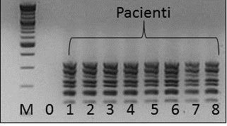 do objemu 5µl. Reakce proběhla po počáteční denaturaci DNA (94 C 5 min) v 35 cyklech při teplotách 94 C 15s, 58 C 30s a 72 C 30s s finální extenzí 72 C 3 min.