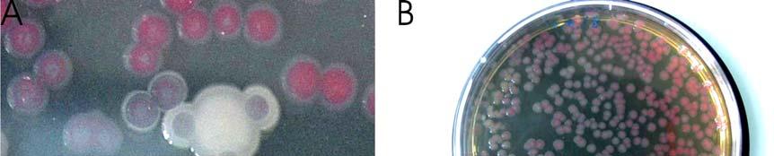 Tab. 7 Na snímcích A a B vidíme monokolonii fenotypu Wpsurround rostoucí v