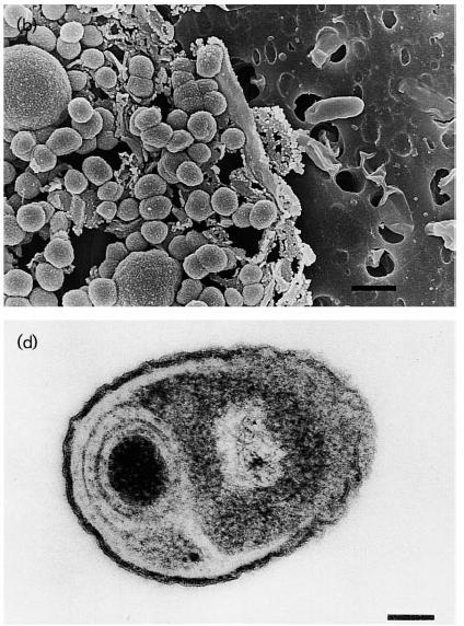 Obr. 7. Endospory Serratie marcescens.