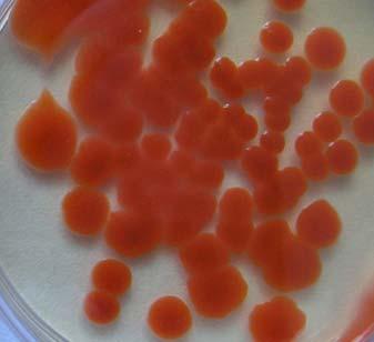 11/4 Oranžová - Or Oranžová kolonie kulatého tvaru s nepravidelným okrajem, celistvá a lesklá, od počátku růstu lehce zvýšená.