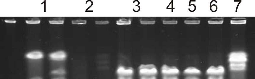 3.1.2 Makrorestrikční analýza na pulzní gelové elektroforéze Ve spolupráci s Laboratoří bakteriální genetiky Centra mikrobiologie a epidemiologie Státního zdravotního ústavu (SZÚ), jsme provedli