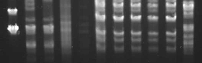 V tomto směru budeme pokračovat v analýzách, zvláště proto, že předběžné biochemické testy na rozklad sorbitolu naznačují, že námi studovaná bakterie by nemusela být druhem Serratia marcescens ale