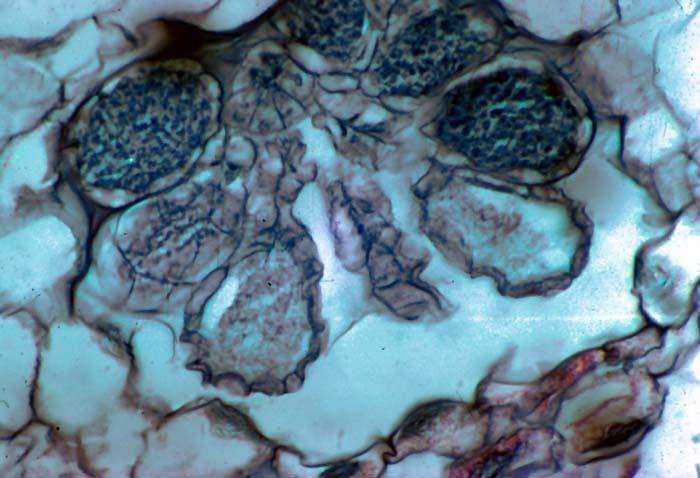 po čtyřech (tetrády), pseudoelatery rhizoidy hladké buňky