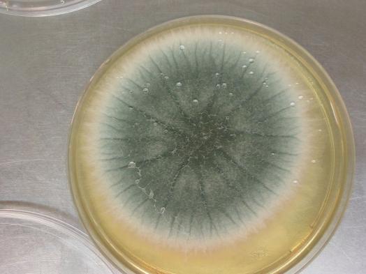 5.4.6 Aspergillus fumigatus : A.