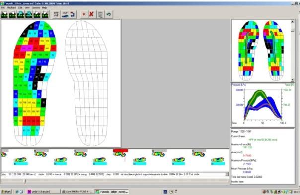 Obr. 8: Zobrazení pomocí programu Pedar-X Standard (www.novel.