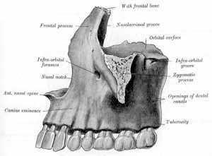 Corpus maxillae: facies orbitalis facies anterior facies infratemporalis