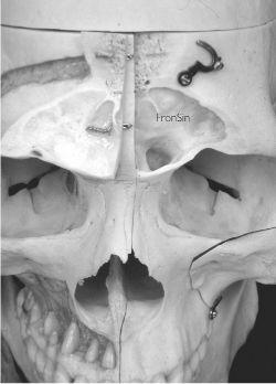 horní čelistí sinus frontalis septum sinuum