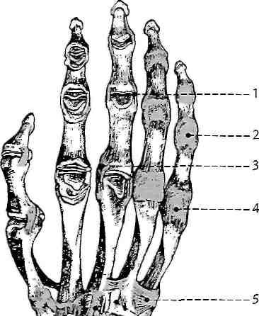 2.1.4 Klouby (s výjimkou os pisiforme) má směrem k předloktí konvexní kloubní plošky, tvořící jako celek eliptickou hlavici zapadající do vyhloubené plochy distálního konce vřetenní kosti.