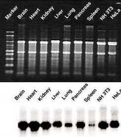 princip Dot blot, Northern blot hybridizace znač ené próby (RNA nebo ssdna komplementární k targetu) se vzorkem o neznámém slož ení (totální RNA, polya RNA), který je či není před detekcí separován a