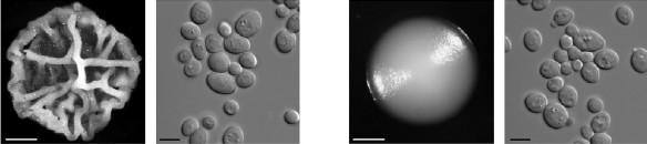 Extracelularní matrix ECM - závisí na ECM (extracellular matrix tj.