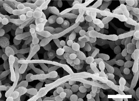 Biofilm - tvořen matrix s mikrokoloniemi kvasinek, hyfami a pseudohyfami (komplexní struktura) - více rezistentní než