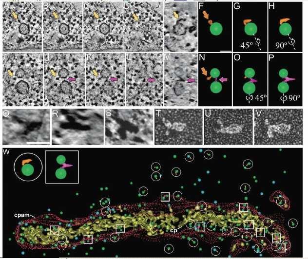 Tomographic analysis of putative vesicle tethering complexes