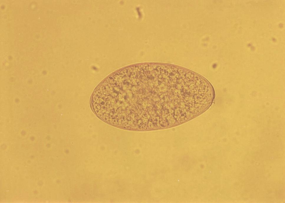 Paraziti přežvýkavců Fasciola hepatica Vajíčka: 130 150 60 90 μm, oválný tvar, jemně granulovaný obsah, žlutohnědé až zlatavé barvy, na jednom pólu opatřené víčkem (operculum), tenká bezbarvá stěna