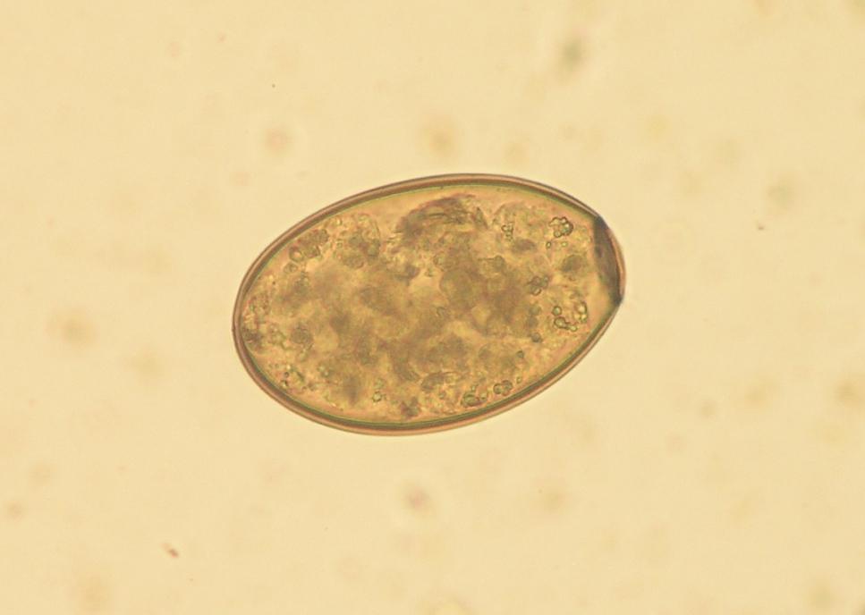 Paraziti přežvýkavců Fascioloides magna Vajíčka: 120 185 70 90 μm, oválný tvar, jemně granulovaný obsah žlutohnědé až zlatavé barvy, na jednom pólu opatřené víčkem (operculum), tenká bezbarvá stěna