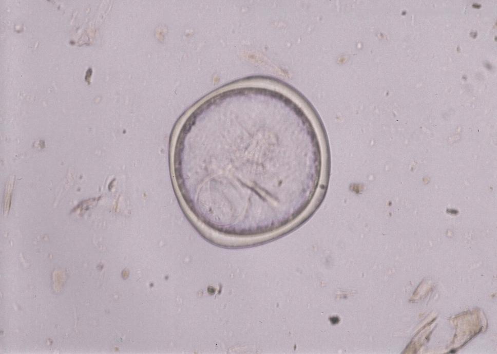 Paraziti přežvýkavců Moniezia benedeni Vajíčka: 80 90 μm, tvar písmene D (čtyřúhelník), emryonovaná s pyriformním aparátem, který je zakončen malým terčíkem Dospělec: 2 a více metrů, scolex s